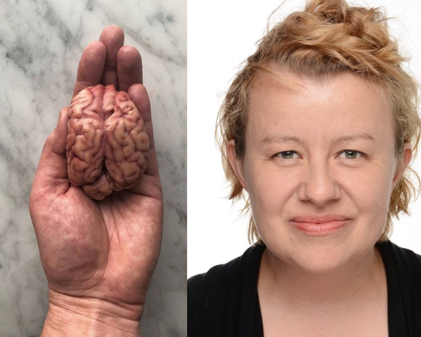 Kristinbrain